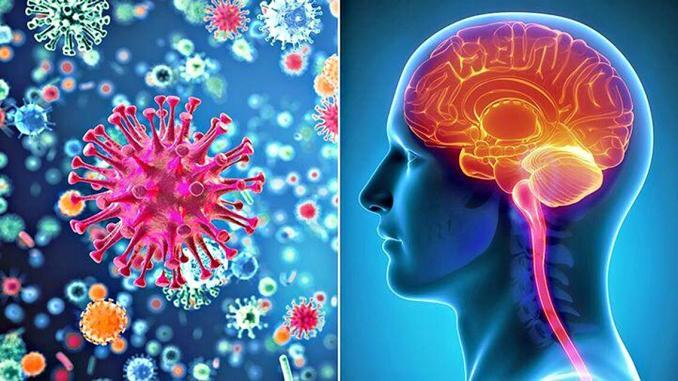 Meningite batterica Meningite batterica